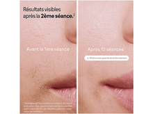 Charger l'image dans la galerie, alt1