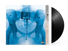 Charger l&#39;image dans la galerie, Pochette d&#39;album avec radiographie de la région pelvienne.
