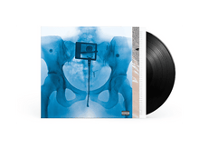 Charger l&#39;image dans la galerie, Pochette d&#39;album avec image radiographique bleue du bassin, disque vinyle noir. Avertissement parental sur la pochette.
