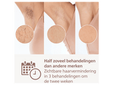PHILIPS Lumea IPL 9900 Series BRP959/00 SkinAI